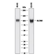 Western blot shows lysates of A549 human lung carcinoma cell line and U2OS human osteosarcoma cell line. PVDF membrane was probed with 2 µg/mL of Mouse Anti-Human ALCAM/CD166 Monoclonal Antibody (Catalog # MAB6562) followed by HRP-conjugated Anti-Rabbit IgG Secondary Antibody (Catalog # HAF008). A specific band was detected for ALCAM/CD166 at approximately 105 kDa (as indicated). This experiment was conducted under reducing conditions and using Immunoblot Buffer Group 1.