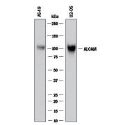 Western blot shows lysates of A549 human lung carcinoma cell line and U2OS human osteosarcoma cell line. PVDF membrane was probed with 2 µg/mL of Rabbit Anti-Human ALCAM/CD166 Monoclonal Antibody (Catalog # MAB6563) followed by HRP-conjugated Anti-Rabbit IgG Secondary Antibody (HAF008). A specific band was detected for ALCAM/CD166 at approximately 105 kDa (as indicated). This experiment was conducted under reducing conditions and using Immunoblot Buffer Group 1.