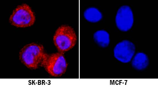 Immunocytochemistry ALDH2 Antibody (1007902) [Unconjugated]