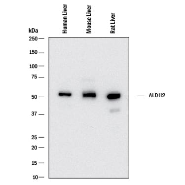 Western Blot ALDH2 Antibody (1007902) [Unconjugated]