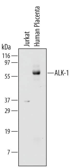 Western Blot ALK-1 Antibody (117720)