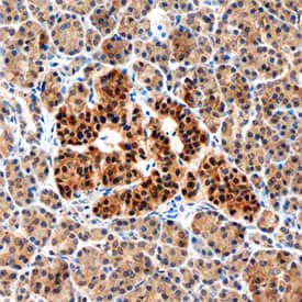 ALK-7 was detected in immersion fixed paraffin-embedded sections of human pancreas using Mouse Anti-Human ALK-7 Monoclonal Antibody (Catalog # MAB7749) at 15 µg/mL overnight at 4 °C. Before incubation with the primary antibody, tissue was subjected to heat-induced epitope retrieval using Antigen Retrieval Reagent-Basic (Catalog # CTS013). Tissue was stained using the Anti-Mouse HRP-DAB Cell & Tissue Staining Kit (brown; Catalog # CTS002) and counter-stained with hematoxylin (blue). Specific staining was localized to islet cells. View our protocol for Chromogenic IHC Staining of Paraffin-embedded Tissue Sections.