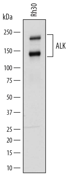 Western Blot ALK/CD246 Antibody [Unconjugated]