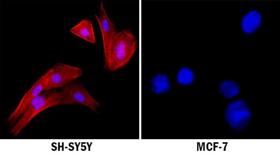 ALK/CD246 was detected in immersion fixed SH-SY5Y human neuroblastoma cell line (left panel; positive staining) and MCF-7 human breast cancer cell line (right panel; negative staining) using Mouse Anti-Human ALK/CD246 Monoclonal Antibody (Catalog # MAB42101) at 8 µg/mL for 3 hours at room temperature. Cells were stained using the NorthernLights™ 557-conjugated Anti-Mouse IgG Secondary Antibody (red; Catalog # NL007) and counterstained with DAPI (blue). Specific staining was localized to plasma membrane and cytoplasm. View our protocol for Fluorescent ICC Staining of Cells on Coverslips.