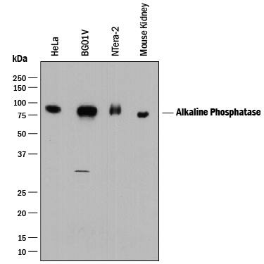 Western blot shows lysates of HeLa human cervical epithelial carcinoma cell line, BG01V human embryonic stem cells, NTera-2 human testicular embryonic carcinoma cell line, and mouse kidney tissue. PVDF membrane was probed with 0.5 µg/mL of Goat Anti-Human/Mouse Alkaline Phosphatase/ALPL Antigen Affinity-purified Polyclonal Antibody (Catalog # AF2909) followed by HRP-conjugated Anti-Goat IgG Secondary Antibody (Catalog # HAF017). A specific band was detected for Alkaline Phosphatase/ALPL at approximately 75-80 kDa (as indicated). This experiment was conducted under reducing conditions and using Immunoblot Buffer Group 1.