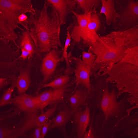 Immunocytochemistry Alkaline Phosphatase/ALPL Antibody [Unconjugated]
