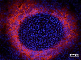 Alkaline Phosphatase/ALPL was detected in immersion fixed frozen sections of mouse embryonic (E13.5) developing vertebra using Goat Anti-Mouse Alkaline Phosphatase/ALPL Antigen Affinity-purified Poly-clonal Antibody (Catalog # AF2910) at 2 µg/mL overnight at 4 °C. Tissue was stained red and counterstained with DAPI (blue).Image courtesy of Paul J. Simmons, Ph.D., Director, Center for Stem Cell Research, The University of Texas Health Science Center at Houston, Houston, Texas, USA.View our protocol for Fluorescent IHC Staining of Frozen Tissue Sections.