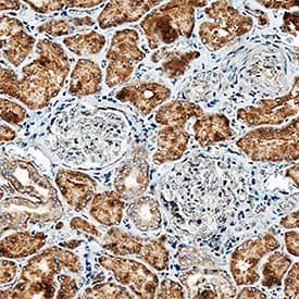 Alkaline Phosphatase/ALPL was detected in immersion fixed paraffin-embedded sections of human kidney using Mouse Anti-Human Alkaline Phosphatase/ALPL Monoclonal Antibody (Catalog # MAB1448) at 15 µg/mL overnight at 4 °C. Tissue was stained using the Anti-Mouse HRP-DAB Cell & Tissue Staining Kit (brown; CTS002) and counterstained with hematoxylin (blue). Specific staining was localized to cytoplasm in epithelial cells. View our protocol for Chromogenic IHC Staining of Paraffin-embedded Tissue Sections.