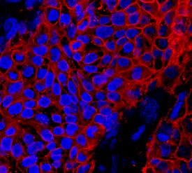 Alkaline Phosphatase/ALPL was detected in immersion fixed BG01V human embryonic stem cells using Rat Anti-Human Alkaline Phosphatase/ALPL Monoclonal Antibody (Catalog # MAB29091) at 10 µg/mL for 3 hours at room temperature. Cells were stained using the NorthernLights™ 557-conjugated Anti-Rat IgG Secondary Antibody (red; Catalog # NL013) and counterstained with DAPI (blue). Specific staining was localized to cell surfaces. View our protocol for Fluorescent ICC Staining of Cells on Coverslips.