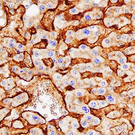 Alkaline Phosphatase/ALPL was detected in immersion fixed paraffin-embedded sections of human liver using Mouse Anti-Human Alkaline Phosphatase/ALPL Monoclonal Antibody (Catalog # MAB29092) at 0.3 µg/mL overnight at 4 °C. Tissue was stained using the Anti-Mouse HRP-DAB Cell & Tissue Staining Kit (brown; CTS002) and counterstained with hematoxylin (blue). Specific staining was localized to bile canaliculi. View our protocol for Chromogenic IHC Staining of Paraffin-embedded Tissue Sections.