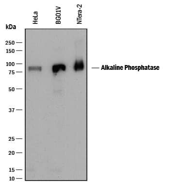 Western blot shows lysates of HeLa human cervical epithelial carcinoma cell line, BG01V human embryonic stem cells, and NTera-2 human testicular embryonic carcinoma cell line. PVDF membrane was probed with 0.25 µg/mL of Mouse Anti-Human Alkaline Phosphatase/ALPL Monoclonal Antibody (Catalog # MAB29092) followed by HRP-conjugated Anti-Mouse IgG Secondary Antibody (HAF018). A specific band was detected for Alkaline Phosphatase/ALPL at approximately 80 kDa (as indicated). This experiment was conducted under reducing conditions and using Immunoblot Buffer Group 1.