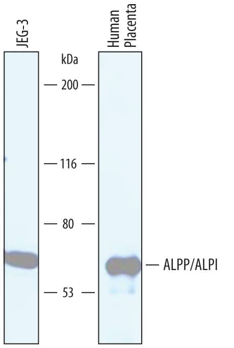 Western blot shows lysates of human placenta tissue and JEG-3 human epithelial choriocarcinoma cell line. PVDF membrane was probed with 1 µg/mL of Sheep Anti-Human Alkaline Phosphatase/ALPP/ALPI Antigen Affinity-purified Polyclonal Antibody (Catalog # AF5905) followed by HRP-conjugated Anti-Sheep IgG Secondary Antibody (Catalog # HAF016). A specific band was detected for Alkaline Phosphatase/ALPP/ALPI at approximately 68 kDa (as indicated). This experiment was conducted under reducing conditions and using Immunoblot Buffer Group 1.