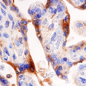 Immunohistochemistry Alkaline Phosphatase/ALPP Antibody (696128) [Unconjugated]