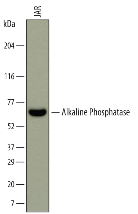 Western Blot Alkaline Phosphatase/ALPP Antibody (696128) [Unconjugated]