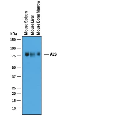 Western Blot ALS Antibody [Unconjugated]
