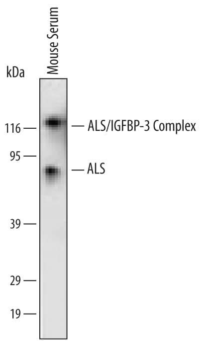 Western Blot ALS Antibody (199410) [Unconjugated]