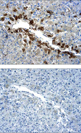 AMPKa1 was detected in immersion fixed paraffin-embedded sections of human liver using 5 µg/mL Goat Anti-Human/Mouse/Rat AMPKa1 Antigen Affinity-purified Polyclonal Antibody (Catalog # AF3197) overnight at 4 °C. Tissue was stained with the Anti-Goat HRP-DAB Cell & Tissue Staining Kit (brown; Catalog # CTS008) and counterstained with hematoxylin (blue). Lower panel shows secondary antibody only control experiment. View our protocol for Chromogenic IHC Staining of Paraffin-embedded Tissue Sections.
