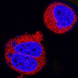 AMPKa1 was detected in immersion fixed MCF-7 human breast cancer cell line using Mouse Anti-Human/Mouse/Rat AMPKa1 Monoclonal Antibody (Catalog # MAB3197) at 8 µg/mL for 3 hours at room temperature. Cells were stained using the NorthernLights™ 557-conjugated Anti-Mouse IgG Secondary Antibody (red; Catalog # NL007) and counterstained with DAPI (blue). Specific staining was localized to nuclei and cytoplasm. View our protocol for Fluorescent ICC Staining of Cells on Coverslips.