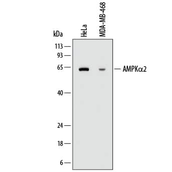 Western blot shows lysates of HeLa human cervical epithelial carcinoma cell line and MDA-MB-468 human breast cancer cell line. PVDF membrane was probed with 2 µg/mL of Mouse Anti-Human AMPKa2 Monoclonal Antibody (Catalog # MAB2850) followed by HRP-conjugated Anti-Mouse IgG Secondary Antibody (Catalog # HAF018). A specific band was detected for AMPKa2 at approximately 63 kDa (as indicated). This experiment was conducted under reducing conditions and using Immunoblot Buffer Group 1.