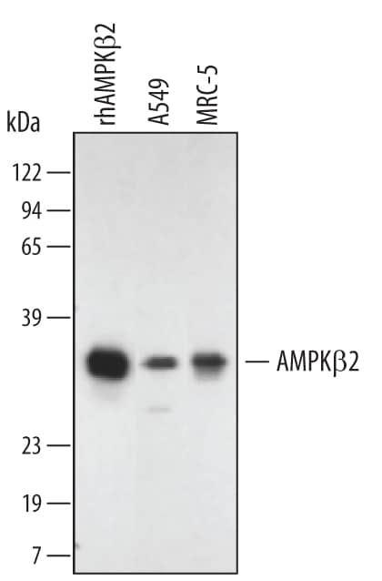 Western Blot AMPK beta 2/PRKAB2 Antibody (376938)