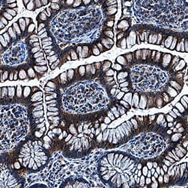 Immunohistochemistry AMSH/STAMBP Antibody [Unconjugated]