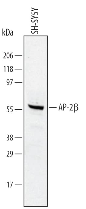 Western Blot AP-2 beta/TFAP2B Antibody
