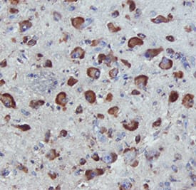 APJ was detected in immersion fixed paraffin-embedded sections of human hypothalamus using Mouse Anti-Human APJ Monoclonal Antibody (Catalog # MAB8561) at 0.5 µg/mL for 1 hour at room temperature followed by incubation with the Anti-Mouse IgG VisUCyte™ HRP Polymer Antibody (Catalog # VC001). Tissue was stained using DAB (brown) and counterstained with hematoxylin (blue). Specific staining was localized to cytoplasm and cell membranes. View our protocol for IHC Staining with VisUCyte HRP Polymer Detection Reagents.