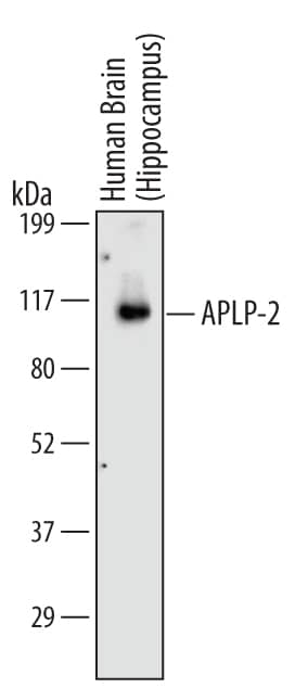 Western Blot APLP-2 Antibody (397702) [Unconjugated]