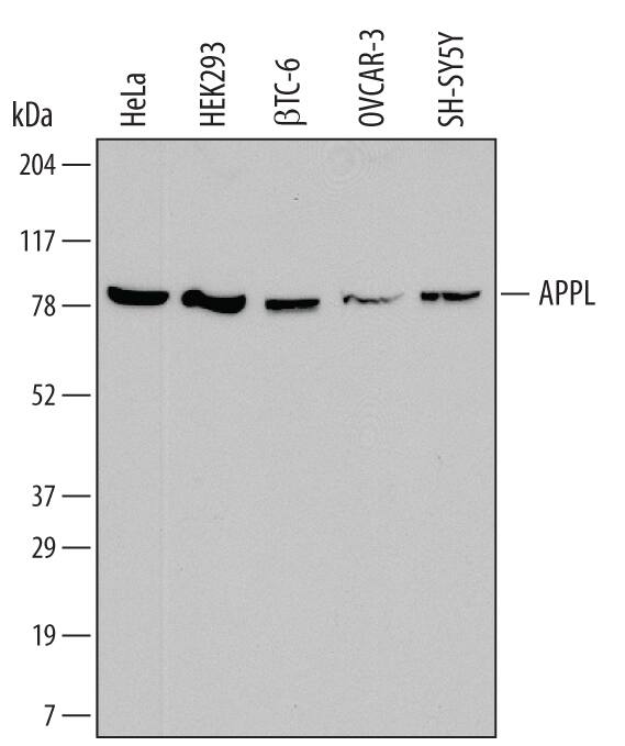 Western blot shows lysates of HeLa human cervical epithelial carcinoma cell line, HEK293 human embryonic kidney cell line,  beta TC-6 mouse beta cell insulinoma cell line, OVCAR-3 human ovarian carcinoma cell line, and SH-SY5Y human neuroblastoma cell line. PVDF membrane was probed with 1 µg/mL of Mouse Anti-Human APPL Monoclonal Antibody (Catalog # MAB7075) followed by HRP-conjugated Anti-Mouse IgG Secondary Antibody (Catalog # HAF007). A specific band was detected for APPL at approximately 80 kDa (as indicated). This experiment was conducted under reducing conditions and using Immunoblot Buffer Group 1.