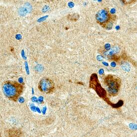 APP695+1was detected in immersion fixed paraffin-embedded sections of human Alzheimer's brain using Goat Anti-Human APP695+1Antigen Affinity-purified Polyclonal Antibody (Catalog # AF890) at 10 µg/mL overnight at 4 °C. Before incubation with the primary antibody, tissue was subjected to heat-induced epitope retrieval using Antigen Retrieval Reagent-Basic (Catalog # CTS013). Tissue was stained using the Anti-Goat HRP-DAB Cell & Tissue Staining Kit (brown; Catalog # CTS008) and counterstained with hematoxylin (blue). Specific staining was localized to cytoplasm. View our protocol for Chromogenic IHC Staining of Paraffin-embedded Tissue Sections.