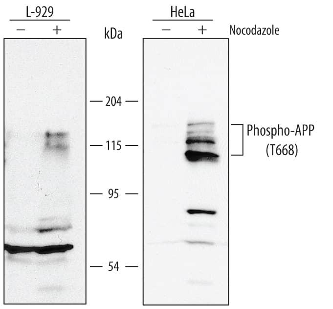 Western blot shows lysates of L-929 mouse fibroblast cell line and HeLa human cervical epithelial carcinoma cell line untreated (-) or treated (+) with 1 µg/mL nocodazole for 16 hours. PVDF membrane was probed with 0.5 µg/mL of Rabbit Anti-Human/Mouse Phospho-APP/Protease Nexin II (T668) Antigen Affinity-purified Polyclonal Antibody (Catalog # AF2508), followed by HRP-conjugated Anti-Rabbit IgG Secondary Antibody (Catalog # HAF008). This experiment was conducted under reducing conditions and using Immunoblot Buffer Group 1.