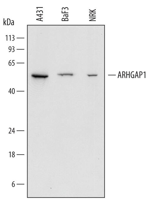 Western blot shows lysates of A431 human epithelial carcinoma cell line, BaF3 mouse pro-B cell line, and NRK rat normal kidney cell line. PVDF Membrane was probed with 0.2 µg/mL of Sheep Anti-Human/Mouse/Rat ARHGAP1 Antigen Affinity-purified Polyclonal Antibody (Catalog # AF6407) followed by HRP-conjugated Anti-Sheep IgG Secondary Antibody (Catalog # HAF016). A specific band was detected for ARHGAP1 at approximately 58 kDa (as indicated). This experiment was conducted under reducing conditions and using Immunoblot Buffer Group 1.