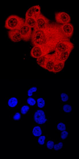 Immunocytochemistry ARNT/HIF-1 beta Antibody [Unconjugated]