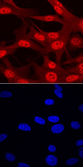 Immunocytochemistry ARX Antibody