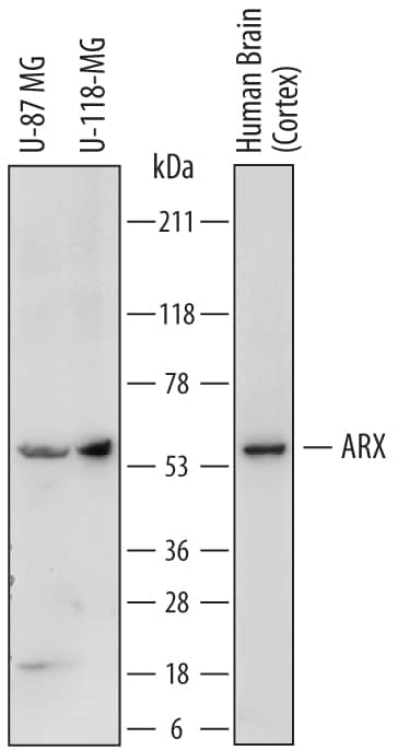 Western Blot ARX Antibody