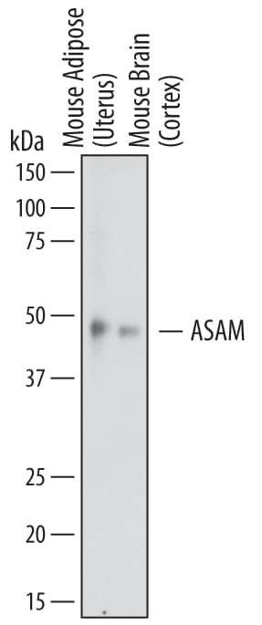 Western Blot ASAM Antibody
