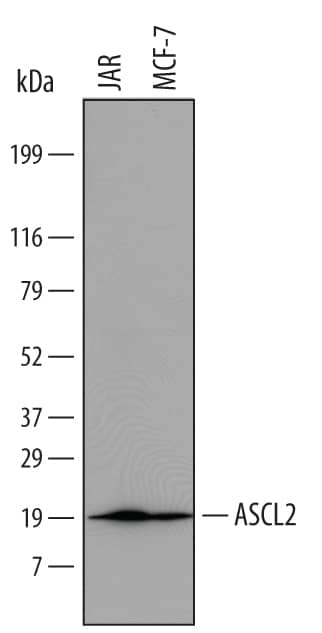 Western Blot ASCL2/Mash2 Antibody [Unconjugated]