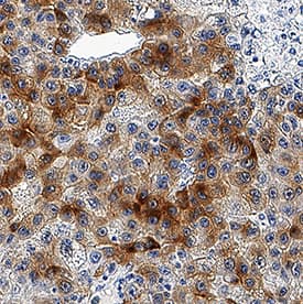 ASGR1/ASGPR1 was detected in immersion fixed paraffin-embedded sections of human liver using Rat Anti-Mouse ASGR1/ASGPR1 Monoclonal Antibody (Catalog # MAB27552) at 5 µg/mL overnight at 4 °C. Tissue was stained using the Anti-Rat HRP-DAB Cell & Tissue Staining Kit (brown; Catalog # CTS017) and counterstained with hematoxylin (blue). Specific staining was localized to cytoplasm in hepatocytes. View our protocol for Chromogenic IHC Staining of Paraffin-embedded Tissue Sections.