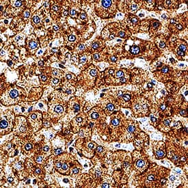 ASGR1/ASGPR1 was detected in immersion fixed paraffin-embedded sections of human liver using Mouse Anti-Human ASGR1/ASGPR1 Monoclonal Antibody (Catalog # MAB43941) at 15 µg/mL for 1 hour at room temperature followed by incubation with the Anti-Mouse IgG VisUCyte™ HRP Polymer Antibody (Catalog # VC001). Tissue was stained using DAB (brown) and counterstained with hematoxylin (blue). Specific staining was localized to cytoplasm and membranes in hepatocytes. View our protocol for IHC Staining with VisUCyte HRP Polymer Detection Reagents.