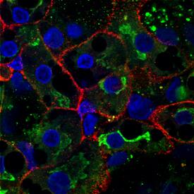 ASGR1/ASGPR1 was detected in immersion fixed BG01V human embryonic stem cells differentiated to hepatocytes using Mouse Anti-Human ASGR1/ASGPR1 Monoclonal Antibody (Catalog # MAB4394) at 10 µg/mL for 3 hours at room temperature. Cells were stained using the NorthernLights™ 557-conjugated Anti-Mouse IgG Secondary Antibody (red; Catalog # NL007) and counterstained with DAPI (blue). Albumin was also detected using Goat Anti-Human/Mouse Serum Albumin Antibody (Catalog # AF3329). Cells were co-stained using the NorthernLights™ 493-conjugated Anti-Goat IgG Secondary Antibody (green; Catalog # NL003). Specific staining of ASGR1/ ASGPR1 was localized to cell surfaces. View our protocol for Fluorescent ICC Staining of Stem Cells on Coverslips.