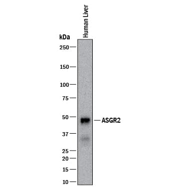 Western Blot Asialoglycoprotein Receptor 2 Antibody (2327C) [Unconjugated]