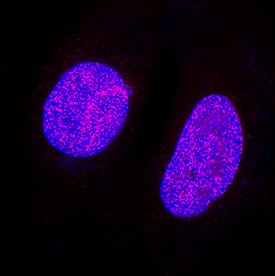 ATAD2 was detected in immersion fixed MCF-7 human breast cancer cell line using Mouse Anti-Human ATAD2 Monoclonal Antibody (Catalog # MAB9169) at 8 µg/mL for 3 hours at room temperature. Cells were stained using the NorthernLights™ 557-conjugated Anti-Mouse IgG Secondary Antibody (red; Catalog # NL007) and counterstained with DAPI (blue). Specific staining was localized to nuclei. View our protocol for Fluorescent ICC Staining of Cells on Coverslips.