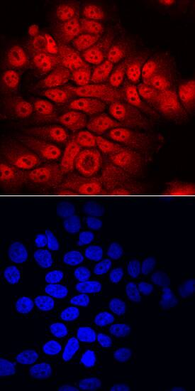 Immunocytochemistry ATBF1/ZFHX3 Antibody [Unconjugated]