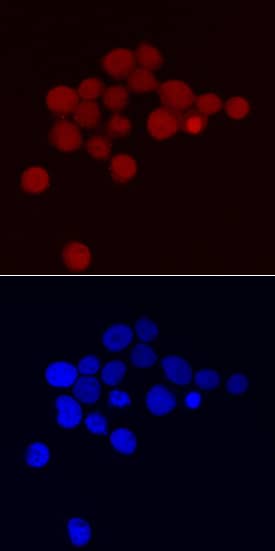 ATF4 was detected in immersion fixed Jurkat human acute T-cell leukemia cell line using Mouse Anti-Human ATF4 Monoclonal Antibody (Catalog # MAB7218) at 10 µg/mL for 3 hours at room temperature. Cells were stained using the NorthernLights™ 557-conjugated Anti-Mouse IgG Secondary Antibody (red, upper panel; Catalog # NL007) and counterstained with DAPI (blue, lower panel). Specific staining was localized to nuclei and cytoplasm. View our protocol for Fluorescent ICC Staining of Non-adherent Cells.