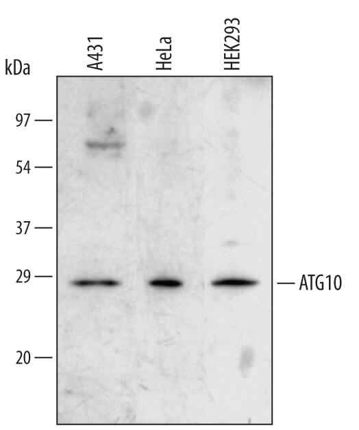 Western blot shows lysates of A431 human epithelial carcinoma cell line, HeLa human cervical epithelial carcinoma cell line, and HEK293 human embryonic kidney cell line. PVDF membrane was probed with 1 µg/mL of Sheep Anti-Human ATG10 Antigen Affinity-purified Polyclonal Antibody (Catalog # AF5464) followed by HRP-conjugated Anti-Sheep IgG Secondary Antibody (Catalog # HAF016). A specific band was detected for ATG10 at approximately 28 kDa (as indicated). This experiment was conducted using Immunoblot Buffer Group 2.