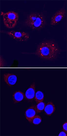 <b>Biological Strategies Validation. </b>ATG3 was detected in immersion fixed RAW 264.7 mouse monocyte/macrophage cell line, untreated (lower panel) or treated with LPS (upper panel), using Sheep Anti-Human/Mouse/Rat ATG3 Antigen Affinity-purified Polyclonal Antibody (Catalog # AF5450) at 5 µg/mL for 3 hours at room temperature. Cells were stained using the NorthernLights™ 557-conjugated Anti-Sheep IgG Secondary Antibody (red; Catalog # NL010) and counterstained with DAPI (blue). Specific staining was localized to autophagosomes. View our protocol for Fluorescent ICC Staining of Non-adherent Cells.