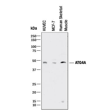 Western blot shows lysates of HUVEC human umbilical vein endothelial cells, MCF-7 human breast cancer cell line, and human skeletal muscle tissue. PVDF membrane was probed with 1 µg/mL of Sheep Anti-Human ATG4A Antigen Affinity-purified Polyclonal Antibody (Catalog # AF4324) followed by HRP-conjugated Anti-Sheep IgG Secondary Antibody (Catalog # HAF016). A specific band was detected for ATG4A at approximately 48 kDa (as indicated). This experiment was conducted under reducing conditions and using Immunoblot Buffer Group 1.