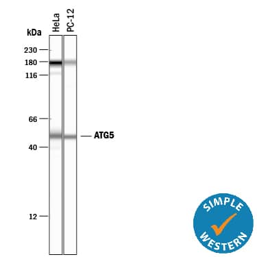 Simple Western lane view shows lysates of HeLa human cervical epithelial carcinoma cell line and PC‑12 rat adrenal pheochromocytoma cell line, loaded at 0.2 mg/mL. A specific band was detected for ATG5 at approximately 51 kDa (as indicated) using 25 µg/mL of Mouse Anti-Human/Mouse/Rat ATG5 Monoclonal Antibody (Catalog # MAB5294). This experiment was conducted under reducing conditions and using the 12-230 kDa separation system.