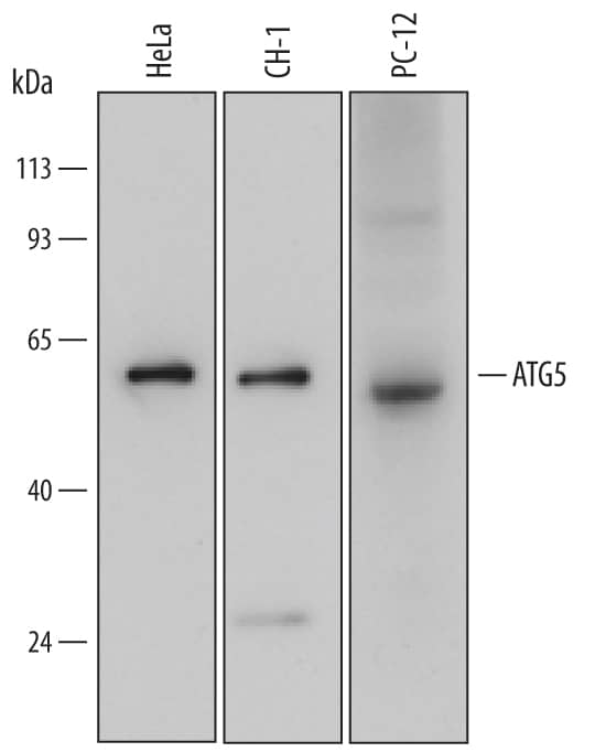 Western blot shows lysates of HeLa human cervical epithelial carcinoma cell line, CH-1 mouse B cell lymphoma cell line, and PC-12 rat adrenal pheochromocytoma cell line. PVDF Membrane was probed with 0.5 µg/mL of Mouse Anti-Human/Mouse/Rat ATG5 Monoclonal Antibody (Catalog # MAB5294) followed by HRP-conjugated Anti-Mouse IgG Secondary Antibody (Catalog # HAF007). A specific band was detected for ATG5 at approximately 50 kDa (as indicated). This experiment was conducted under reducing conditions and using Immunoblot Buffer Group 2.