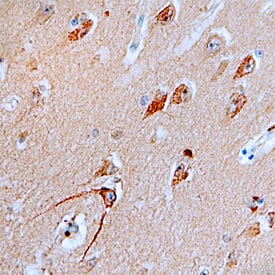 Immunohistochemistry ATG7 Antibody (683906) [Unconjugated]